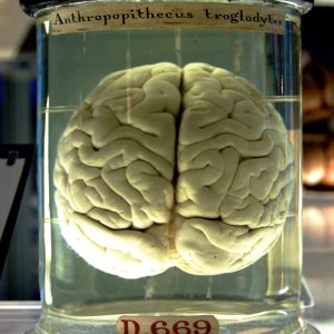 Image: Chimp Brain in a Jar Wikimedia Commons